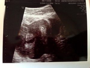 You have to look close, but in the middle of the screen you will see a white dot (close the the cursor arrow) which are our babies!!! :)