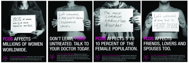 PCOS4
